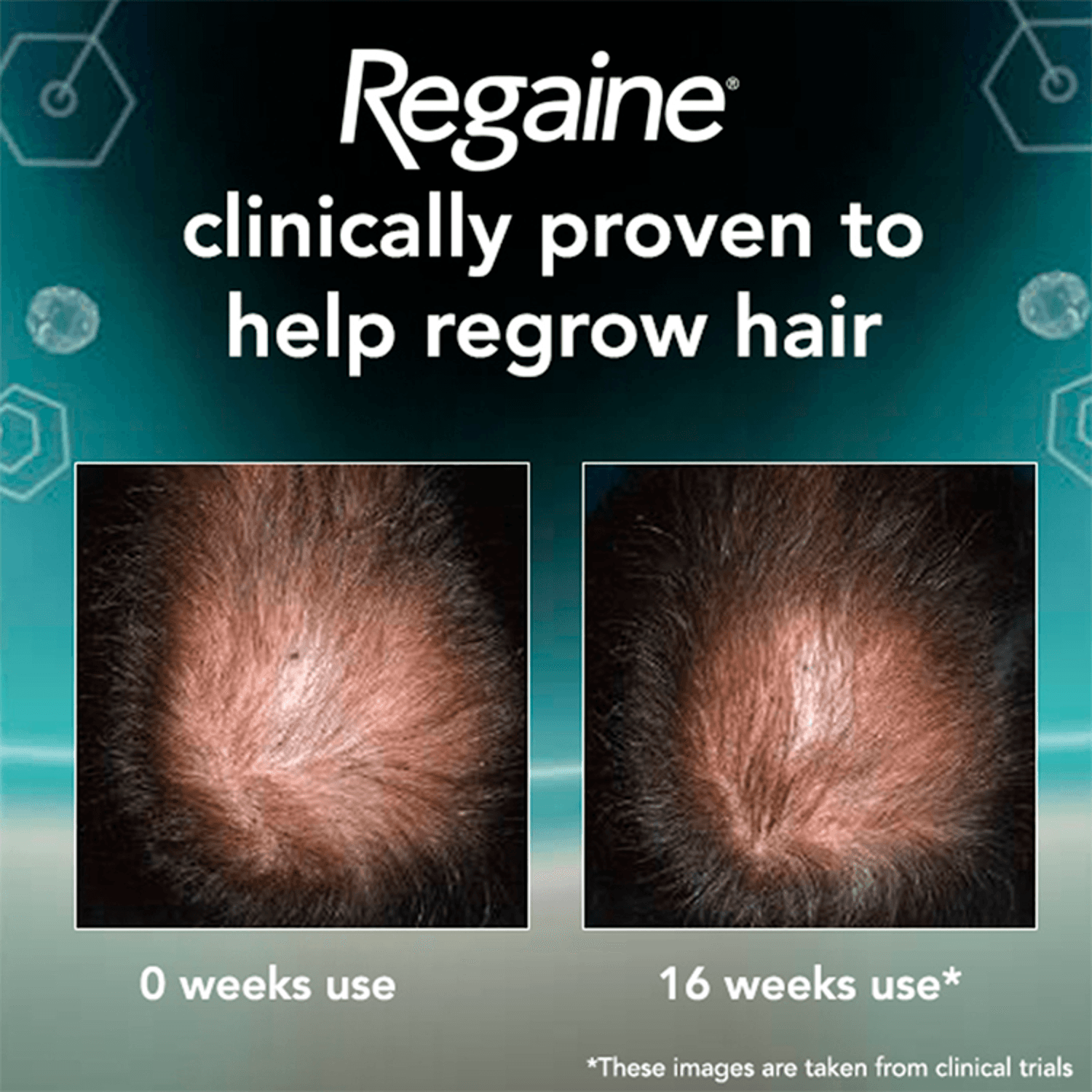 Regaine® for Men Extra Strength Scalp Foam 5% w/w Minoxidil (3 x 73ml)